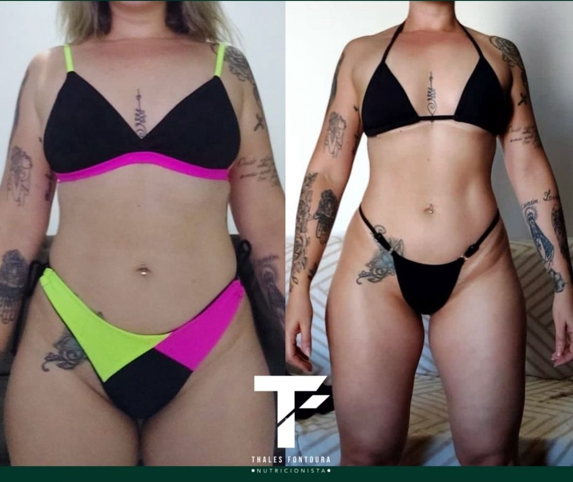 Hipertrofia feminina