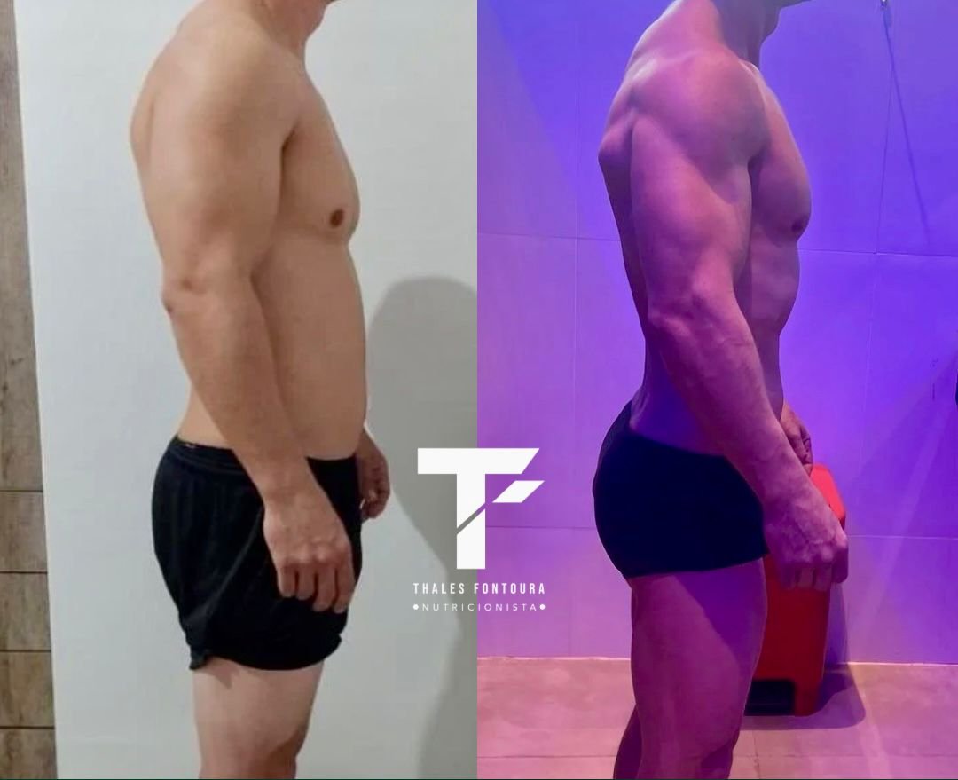 Hipertrofia masculina